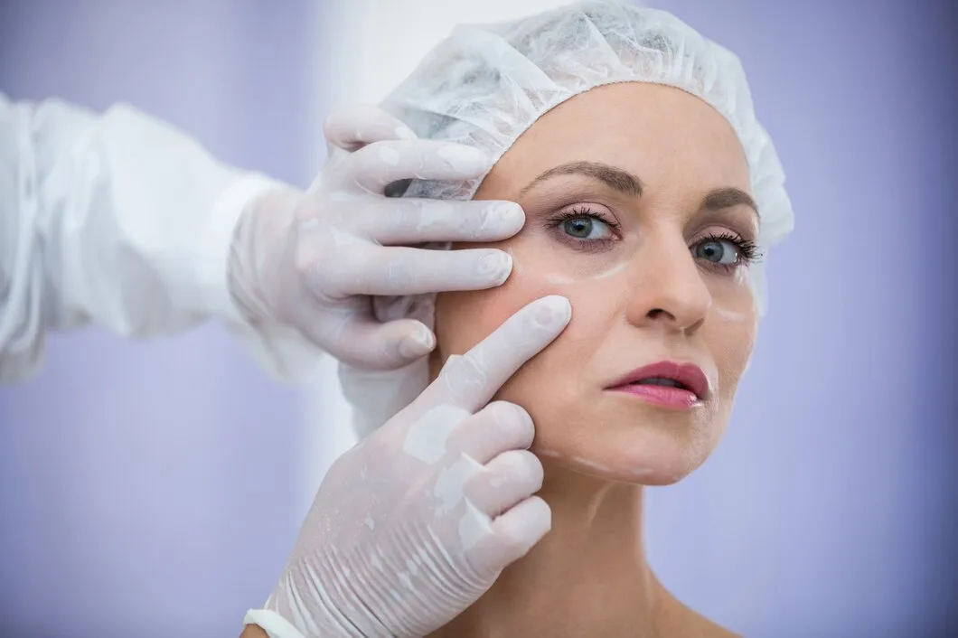 Face and jawline illustration for facelift surgery
