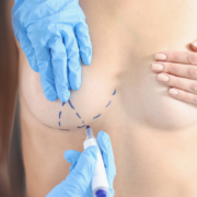 Breast Implant Breast Lift Breast Reduction