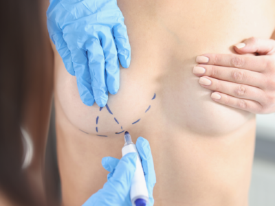 Breast Implant Breast Lift Breast Reduction