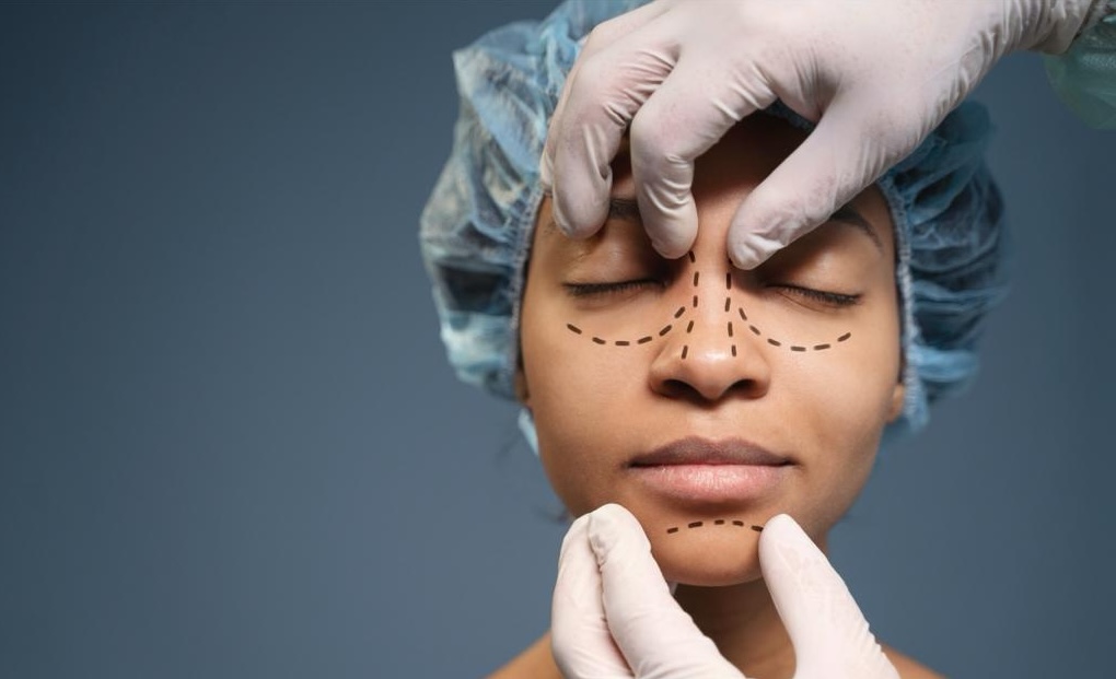 Doctor marked woman's face for a plastic surgery rhinoplasty