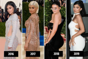 Kylie Jenner BBL transformation